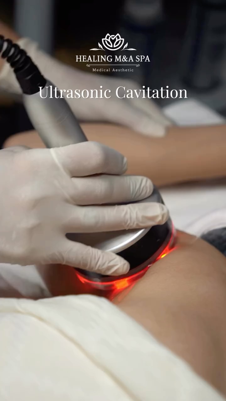 Ultrasonic Cavitation body contouring
